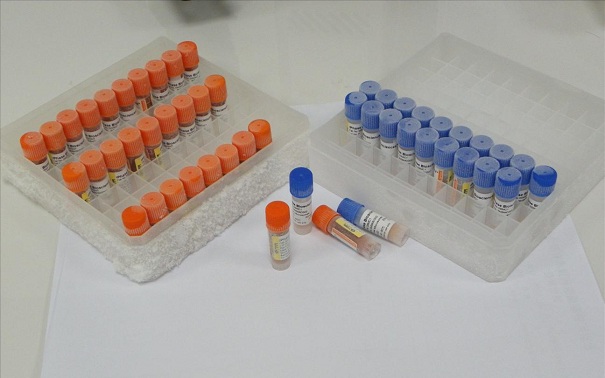 生物指示劑有哪些分類？它的應用情況是這樣的！